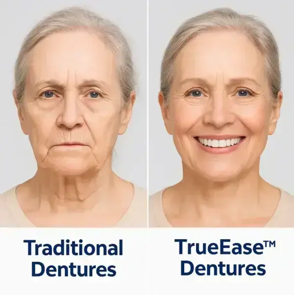 Dentures - Image 5