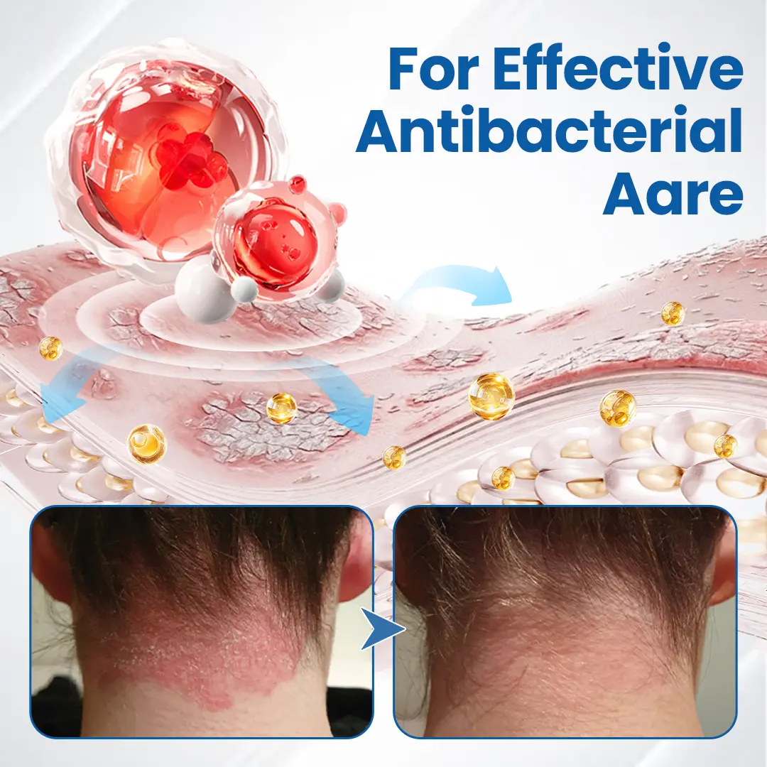 Fragile Skin Repair Cream - Image 10