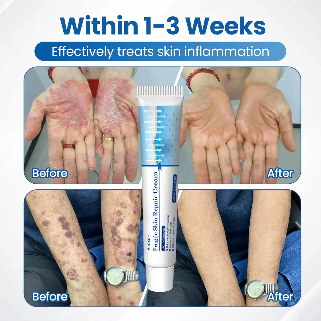 Fragile Skin Repair Cream - Image 2