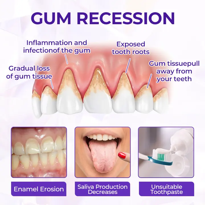 SensiGum Fluoride Toothpaste - Image 7