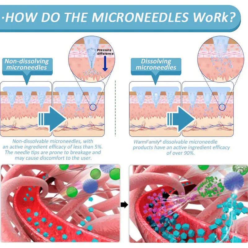Nano Microneedle Patch - Image 12