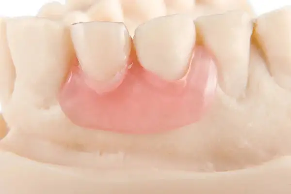Premium Denture - Image 6