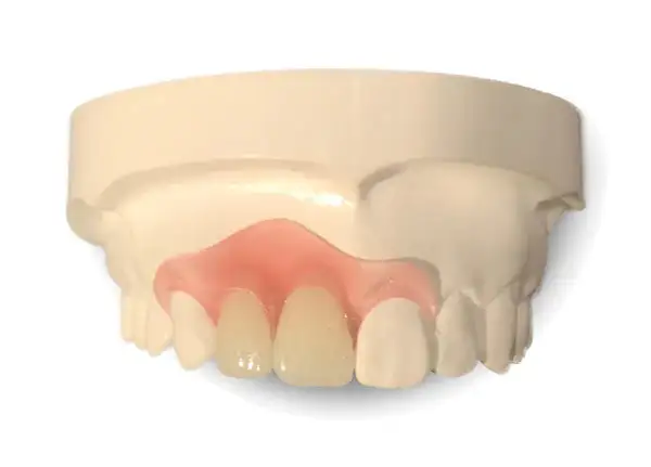 Premium Denture - Image 7