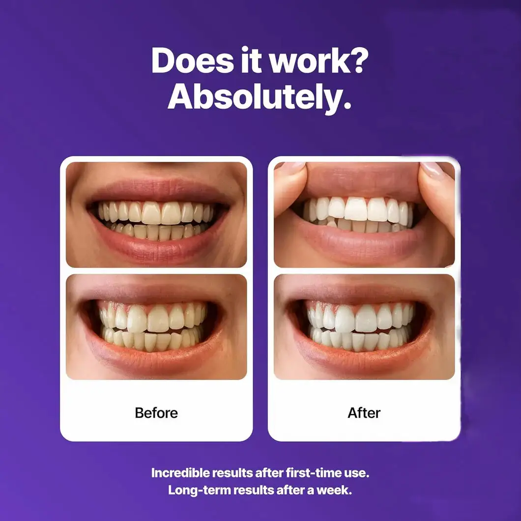 Whitening Strips - Image 7