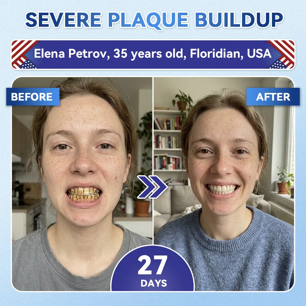 Your Smile~ ๐ฆท Tideglusib FastโDissolving Tooth & Gum Repair Oral Strips โจ (๐-๐ข๐ง-๐ ๐ ๐๐๐๐ฎ๐ข๐ฅ๐ ๐๐ง๐๐ฆ๐๐ฅ & ๐๐๐ง๐ญ๐ข๐ง โข ๐๐ญ๐ซ๐๐ง๐ ๐ญ๐ก๐๐ง ๐๐ฎ๐ฆ๐ฌ โข ๐๐ซ๐๐๐ข๐๐๐ญ๐ ๐๐๐ซ๐ญ๐๐ซ & ๐๐๐จ๐ซ โข ๐๐ก๐ข๐ญ๐๐ง๐ข๐ง๐ โข ๐๐ญ๐จ๐ฉ ๐๐จ๐จ๐ญ๐ก ๐๐๐ง๐ฌ๐ข๐ญ๐ข๐ฏ๐ข๐ญ๐ฒ) - Image 11