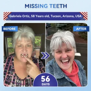 Your Smile~ ๐ฆท Tideglusib FastโDissolving Tooth & Gum Repair Oral Strips โจ (๐-๐ข๐ง-๐ ๐ ๐๐๐๐ฎ๐ข๐ฅ๐ ๐๐ง๐๐ฆ๐๐ฅ & ๐๐๐ง๐ญ๐ข๐ง โข ๐๐ญ๐ซ๐๐ง๐ ๐ญ๐ก๐๐ง ๐๐ฎ๐ฆ๐ฌ โข ๐๐ซ๐๐๐ข๐๐๐ญ๐ ๐๐๐ซ๐ญ๐๐ซ & ๐๐๐จ๐ซ โข ๐๐ก๐ข๐ญ๐๐ง๐ข๐ง๐ โข ๐๐ญ๐จ๐ฉ ๐๐จ๐จ๐ญ๐ก ๐๐๐ง๐ฌ๐ข๐ญ๐ข๐ฏ๐ข๐ญ๐ฒ) - Image 2