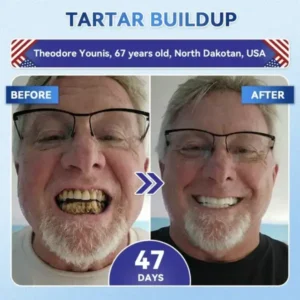 Your Smile~ ๐ฆท Tideglusib FastโDissolving Tooth & Gum Repair Oral Strips โจ (๐-๐ข๐ง-๐ ๐ ๐๐๐๐ฎ๐ข๐ฅ๐ ๐๐ง๐๐ฆ๐๐ฅ & ๐๐๐ง๐ญ๐ข๐ง โข ๐๐ญ๐ซ๐๐ง๐ ๐ญ๐ก๐๐ง ๐๐ฎ๐ฆ๐ฌ โข ๐๐ซ๐๐๐ข๐๐๐ญ๐ ๐๐๐ซ๐ญ๐๐ซ & ๐๐๐จ๐ซ โข ๐๐ก๐ข๐ญ๐๐ง๐ข๐ง๐ โข ๐๐ญ๐จ๐ฉ ๐๐จ๐จ๐ญ๐ก ๐๐๐ง๐ฌ๐ข๐ญ๐ข๐ฏ๐ข๐ญ๐ฒ) - Image 4