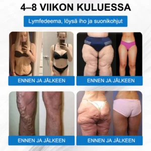 Nano-Mikroneula Laihdutuslaastari - Image 10