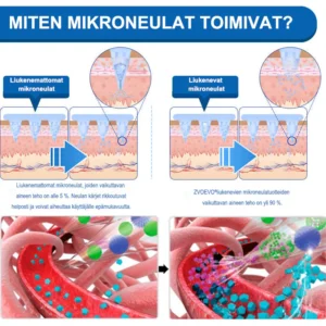 Nano-Mikroneula Laihdutuslaastari - Image 15