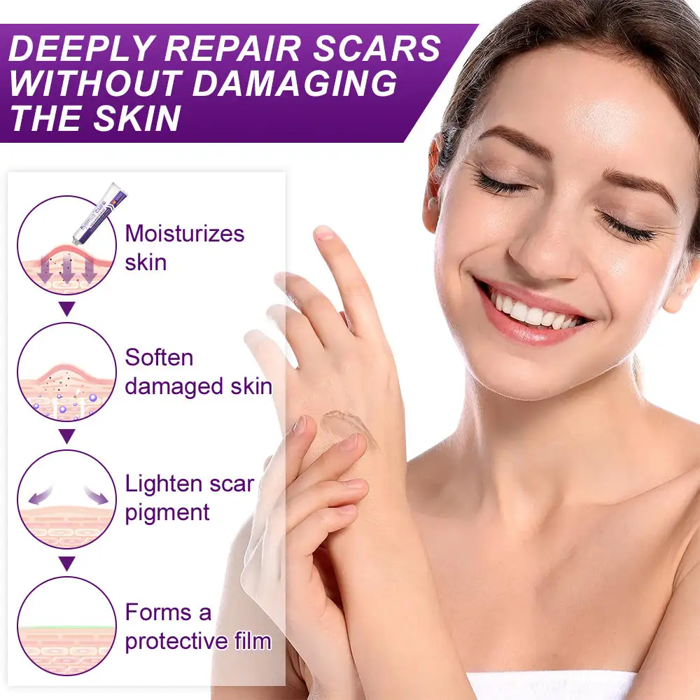 cure FACE & BODY SCAR GEL - Image 5