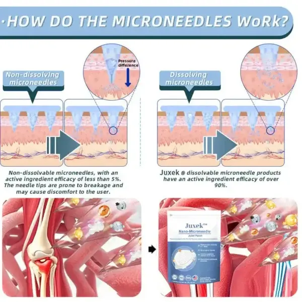 microneedle joint patch - Image 7