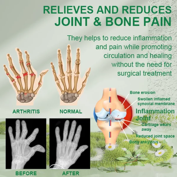 Bee Venom Joint & Bone Therapy Cream - Image 3