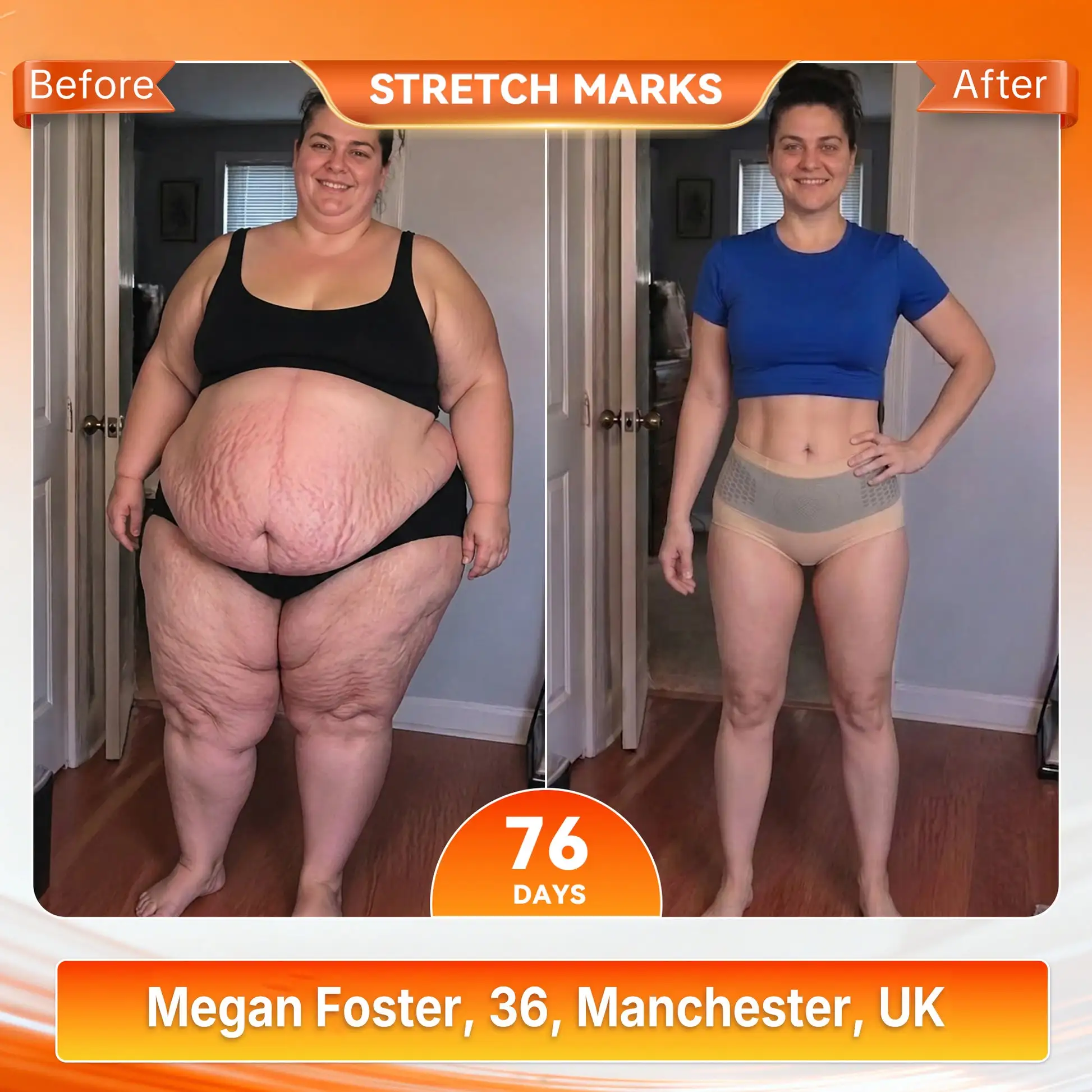 Moringa & Berberine 4In1 MicroParticle Sculpting & FatBurn Shorts