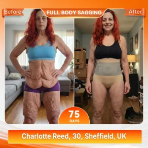 Moringa & Berberine 4In1 MicroParticle Sculpting & FatBurn Shorts - Image 3