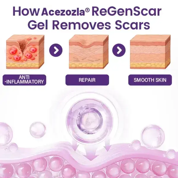 ReGenScar Stem Cell Scar Gel - Image 7