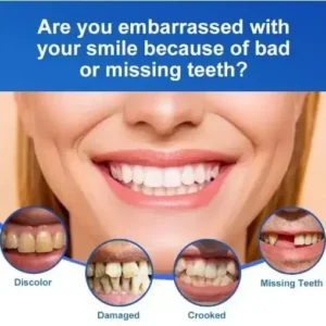 Advanced Customized Full Denture Set🦷 - Image 4