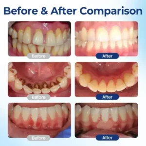 BeeTakt Oral Repair Solution - Image 5