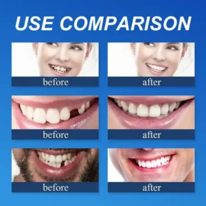 🦷Custom-Fit Dentures | Smile with Confidence - Image 6