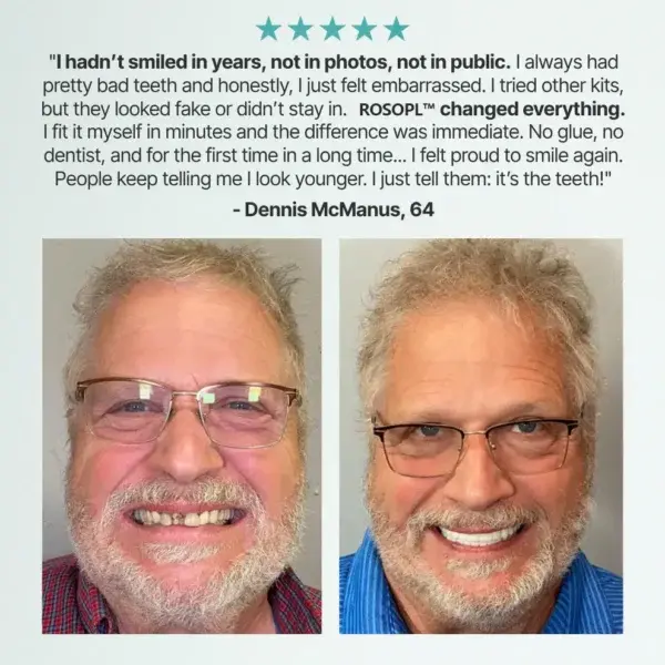 -Ends Today: 70% Custom-Fit Full Functional Dentures Make you more confident - Image 10