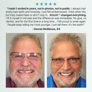 -Ends Today: 70% Custom-Fit Full Functional Dentures Make you more confident - Image 10