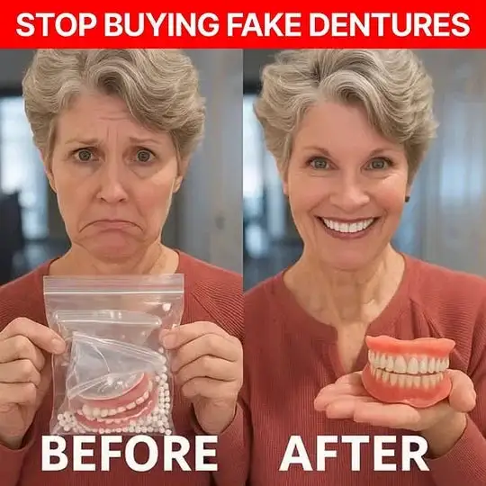 -Ends Today: 70% Custom-Fit Full Functional Dentures Make you more confident - Image 5