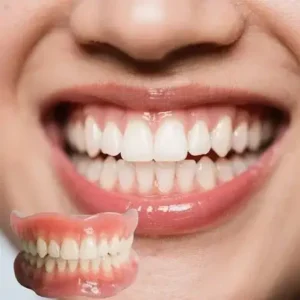 Alternative view of 🔥🔥🔥Ends Today: 70% Custom-Fit Full Functional Dentures Make you more confident