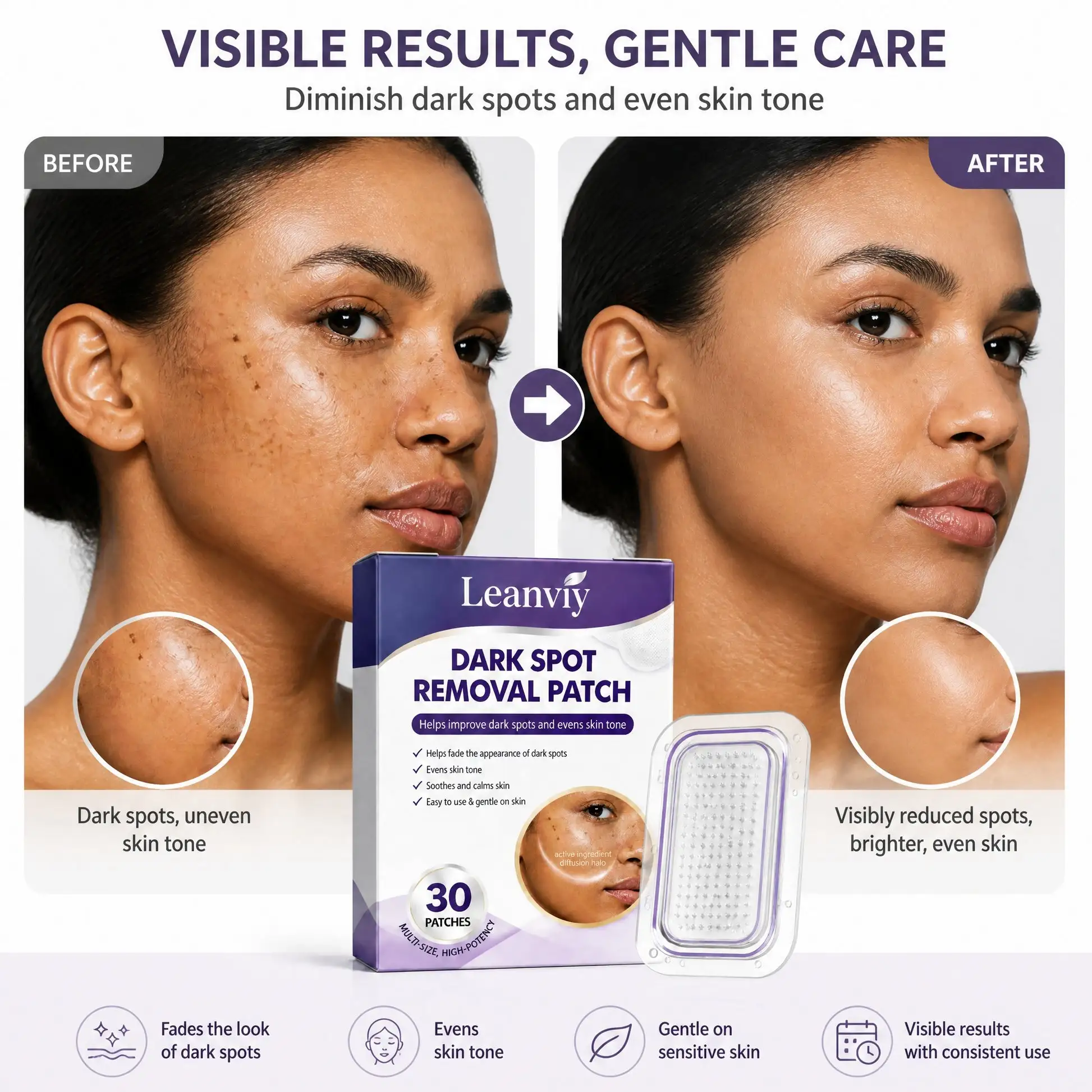 Leanviy Dark Spot Removal Patch|Nano Microneedle Technology · Visible Results in 7 Days - Image 2