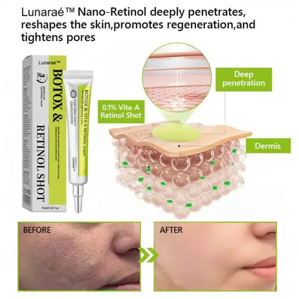 Botox & Retinol Shot - Image 12