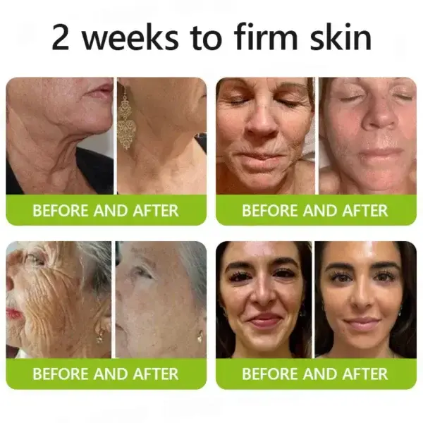 Botox & Retinol Shot - Image 15