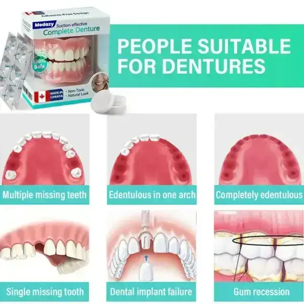 Suction-fit Complete Denture 🦷🍎🍏 - Image 6
