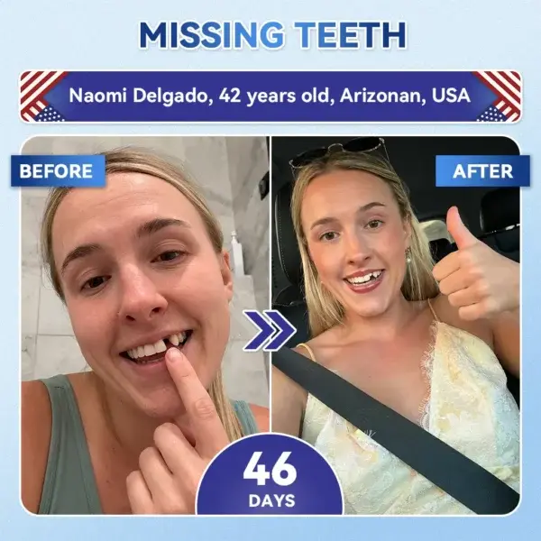 🦷 Tideglusib Fast‑Dissolving Tooth & Gum Repair Oral Strips 😁 (Supports tooth repair and helps relieve gum discomfort and other common oral concerns) - Image 3