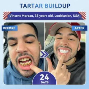 🦷 Tideglusib Fast‑Dissolving Tooth & Gum Repair Oral Strips 😁 (Supports tooth repair and helps relieve gum discomfort and other common oral concerns) - Image 5