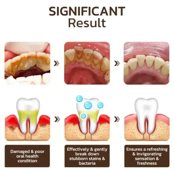 Niacinamide Whitening Toothpaste - Image 5