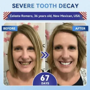 Your Smile~ ๐ฆท Tideglusib FastโDissolving Tooth & Gum Repair Oral Strips โจ (๐-๐ข๐ง-๐ ๐ ๐๐๐๐ฎ๐ข๐ฅ๐ ๐๐ง๐๐ฆ๐๐ฅ & ๐๐๐ง๐ญ๐ข๐ง โข ๐๐ญ๐ซ๐๐ง๐ ๐ญ๐ก๐๐ง ๐๐ฎ๐ฆ๐ฌ โข ๐๐ซ๐๐๐ข๐๐๐ญ๐ ๐๐๐ซ๐ญ๐๐ซ & ๐๐๐จ๐ซ โข ๐๐ก๐ข๐ญ๐๐ง๐ข๐ง๐ โข ๐๐ญ๐จ๐ฉ ๐๐จ๐จ๐ญ๐ก ๐๐๐ง๐ฌ๐ข๐ญ๐ข๐ฏ๐ข๐ญ๐ฒ) - Image 3