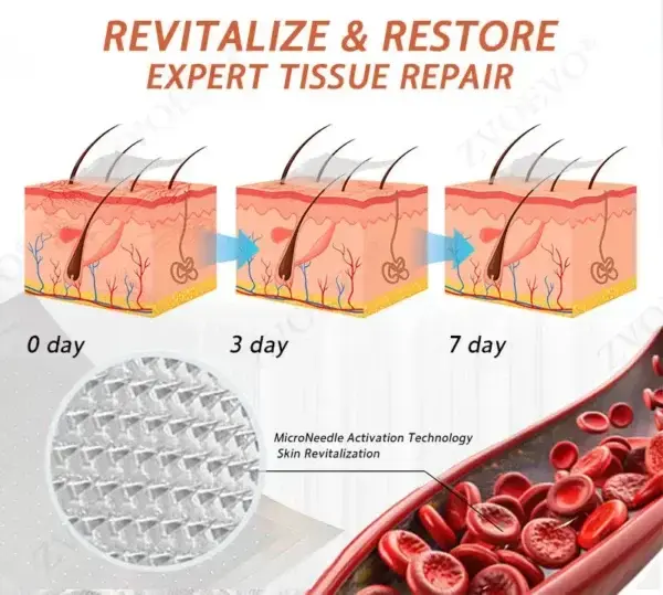 Vein Ease Microneedle Care Patch - Image 11