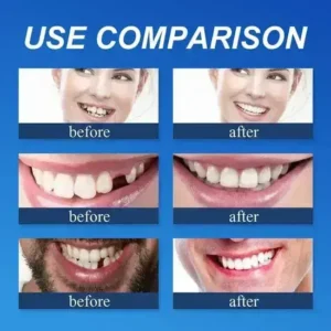⏰Ends Today: 70% OFF! Custom-Fit Dentures— Designed for Comfort and a Natural-Looking Smile - Image 7