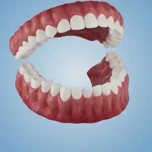 Alternative view of -🦷𝐀𝐝𝐯𝐚𝐧𝐜𝐞𝐝 𝐂𝐮𝐬𝐭𝐨𝐦𝐢𝐳𝐞𝐝 𝐅𝐮𝐥𝐥 𝐃𝐞𝐧𝐭𝐮𝐫𝐞 𝐒𝐞𝐭🦷 (🌟Limited time discount last 30 minutes🌟)🌟🌟