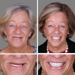 🏆Ends Today: 70% OFF! 🏆2026 Bestselling Product🦷 Fit for a Fresh Smile, Say Goodbye to Wearing Discomfort!🌎 - Image 8