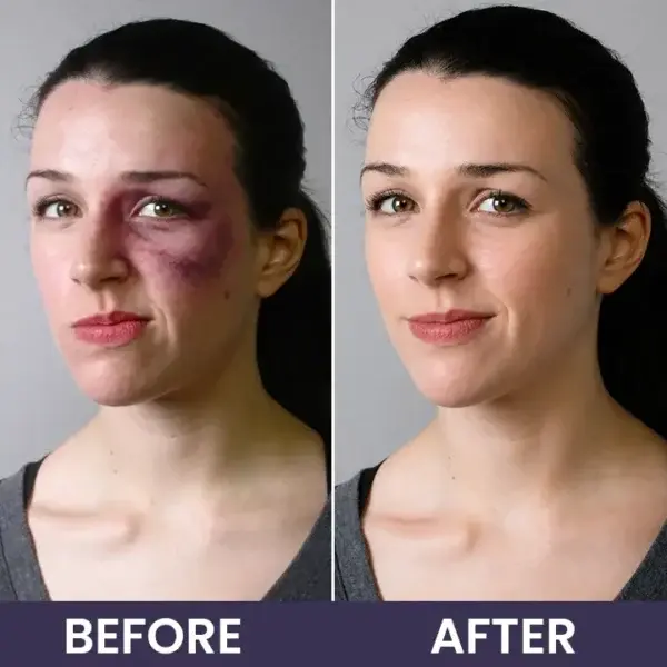 Bruise Repair & Skin-Strengthening Cream - Image 15