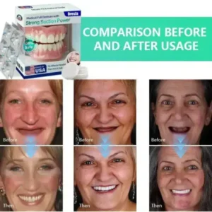 🔥Limited Time 50% OFF: 2nd ltem 60% Full Denture with Strong Suction ✅ Made and Shipped from the USA🍀 - Image 2