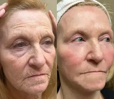 Powerful All-Body Skin Treatment Cream - Image 3