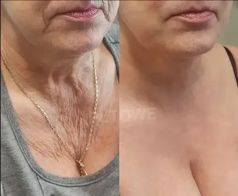 Powerful All-Body Skin Treatment Cream - Image 4