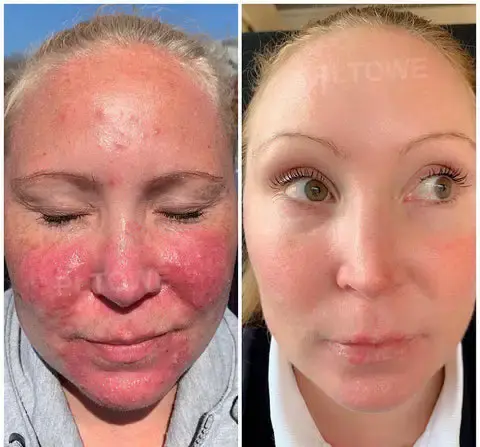 Powerful All-Body Skin Treatment Cream - Image 5