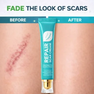 Scar Repair Cream|Treats Old and New Scars, Burns and More - Image 2