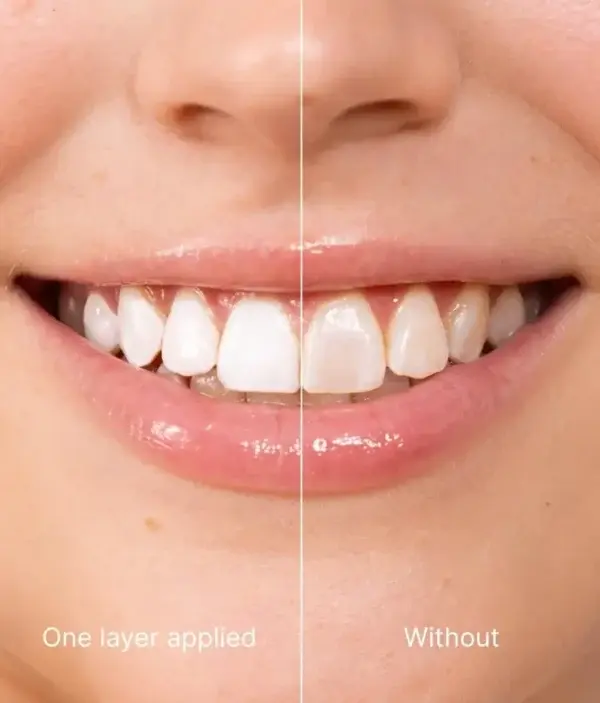 Tooth Polish | Instant White Smile - Image 4
