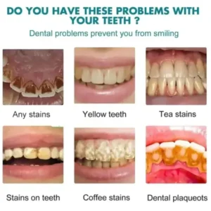 Tooth Polish | Instant White Smile - Image 6