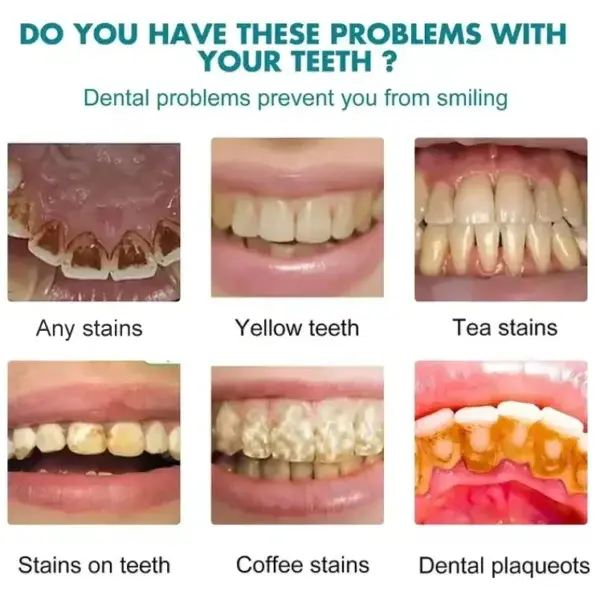 Tooth Polish | Instant White Smile - Image 6