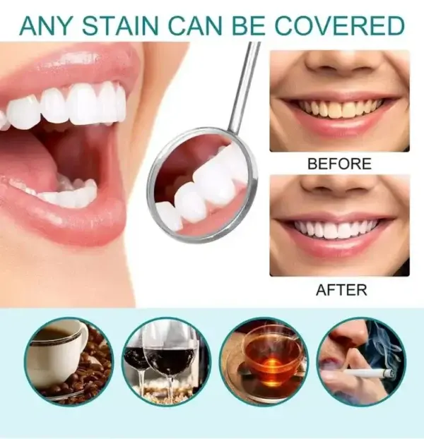 Tooth Polish | Instant White Smile - Image 7