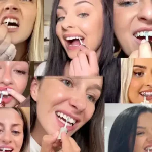 Tooth Polish | Instant White Smile - Image 8