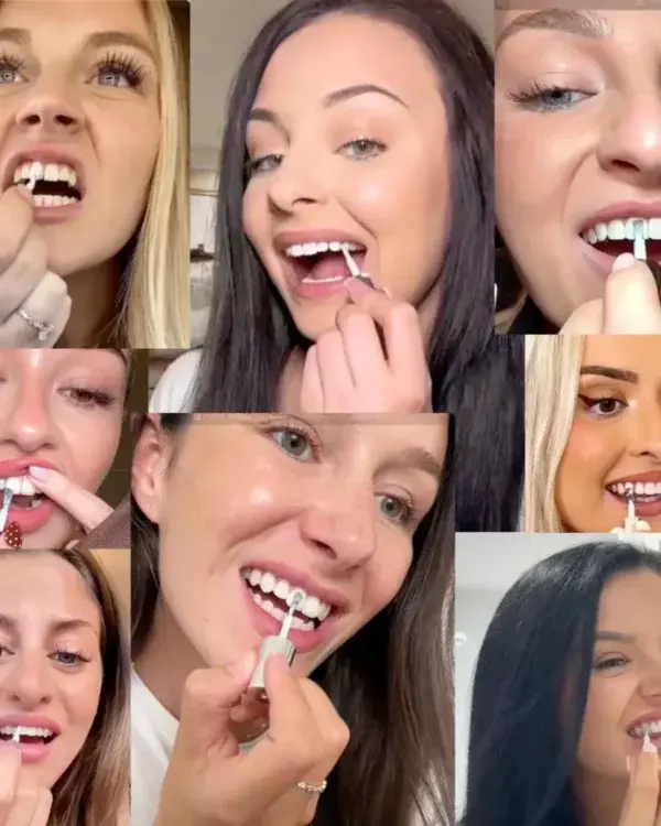 Tooth Polish | Instant White Smile - Image 8